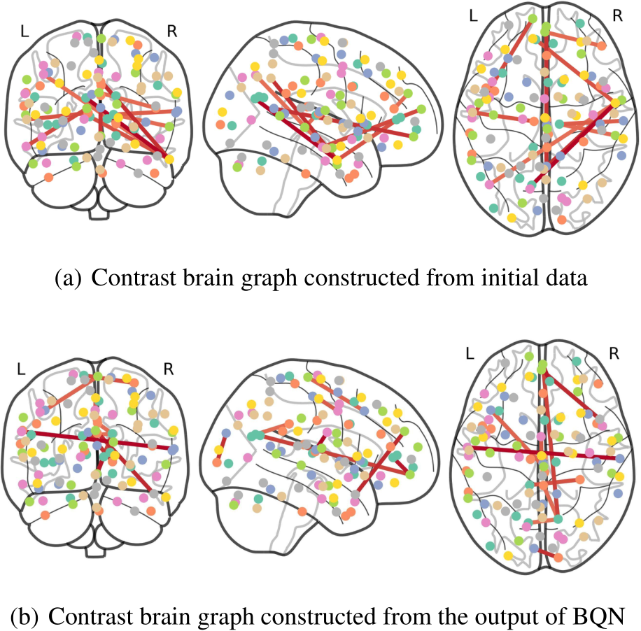 ICML Poster Do We Really Need Message Passing in Brain Network