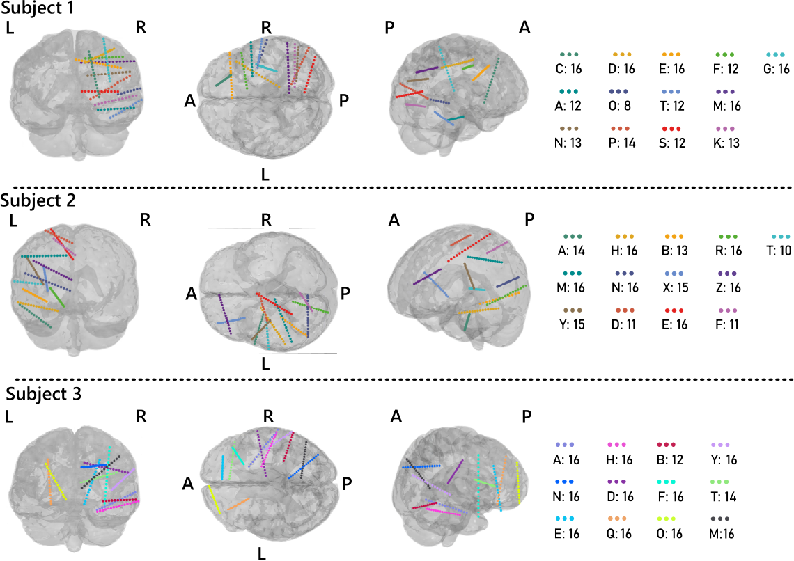 Listening to the Brain: Multi-Band sEEG Auditory Reconstruction via ...