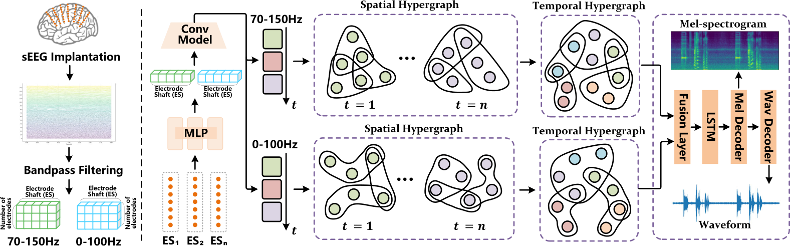 Listening to the Brain: Multi-Band sEEG Auditory Reconstruction via ...
