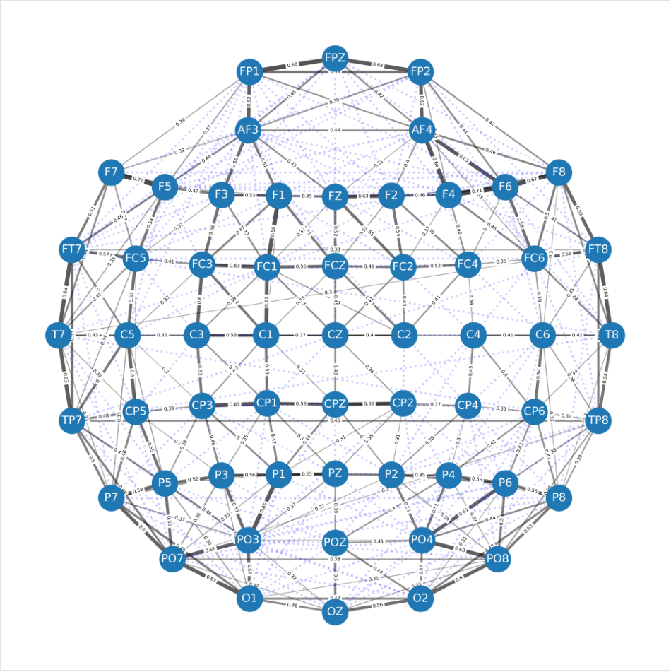 NeurIPS Poster EEGPT: Pretrained Transformer for Universal